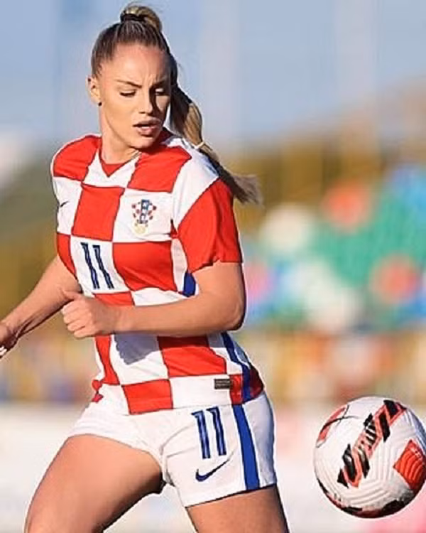 Nhan sac nu cau thu quyen ru nhat the gioi vua chan thuong nang-Hinh-3