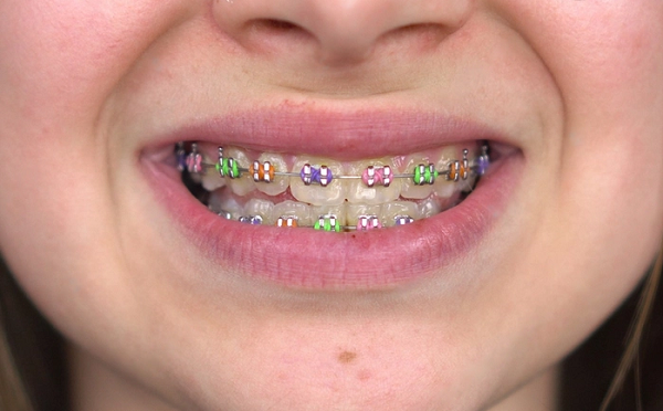 Tung co thoi diem “nieng rang thoi trang” tro thanh con sot