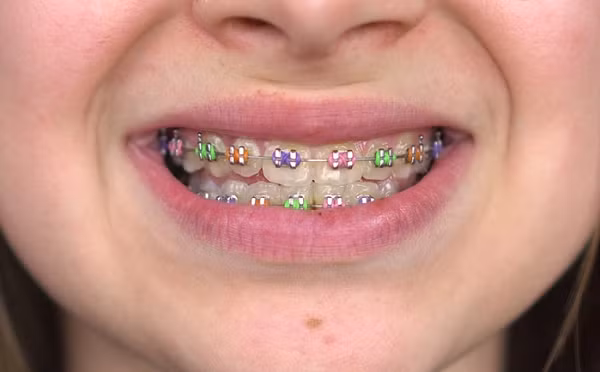 Tung co thoi diem “nieng rang thoi trang” tro thanh con sot