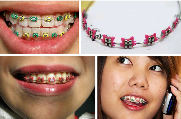 Tung co thoi diem “nieng rang thoi trang” tro thanh con sot-Hinh-3