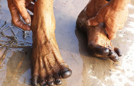 Nong dan soc vi hien tuong chan den thui sau loi ruong-Hinh-2