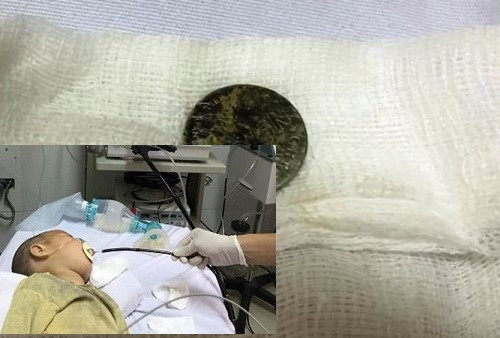 Be 17 thang suyt chet vi hoc pin