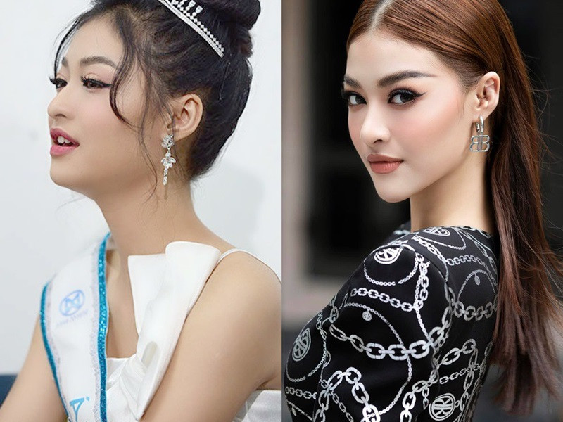 Nàng á hậu 1 cuộc thi Hoa hậu Thế giới Việt Nam 2019 cho biết, cô khóc rất nhiều và tự ti trước những bình luận ác ý về vẻ ngoài. Vì vậy, Kiều Loan quyết định dao kéo. Ảnh: Sức khỏe và đời sống