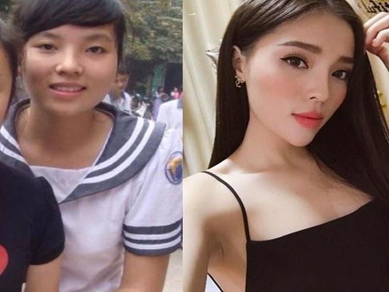 Soi sac voc Ky Duyen - Kieu Loan sau khi dao keo