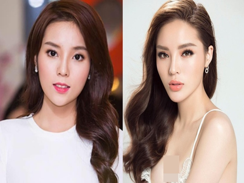 Trước tin đồn phẫu thuật thẩm mỹ gương mặt,, Kỳ Duyên từng phủ nhận và cho biết cô chỉ sử dụng phương pháp bấm huyệt để gương mặt nhỏ gọn. Ảnh: Zing