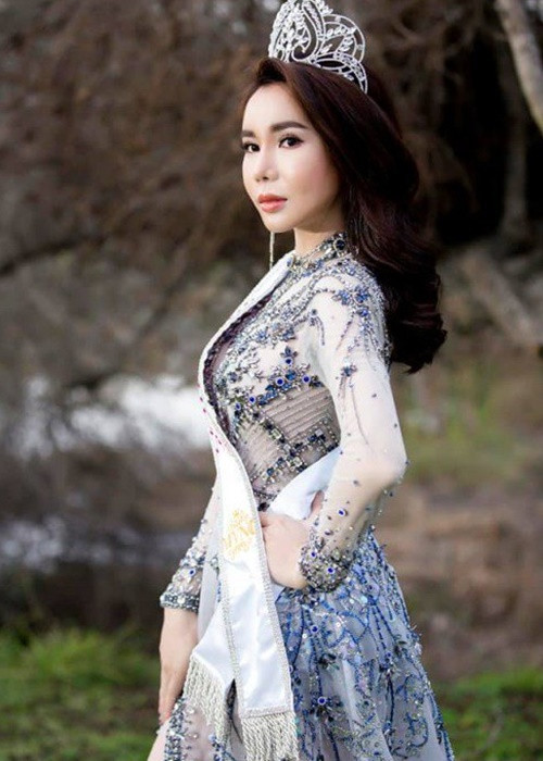 Chân dài sinh năm 1990 sở hữu vóc dáng thon gọn, gợi cảm. Ảnh: Sức khỏe đời sống