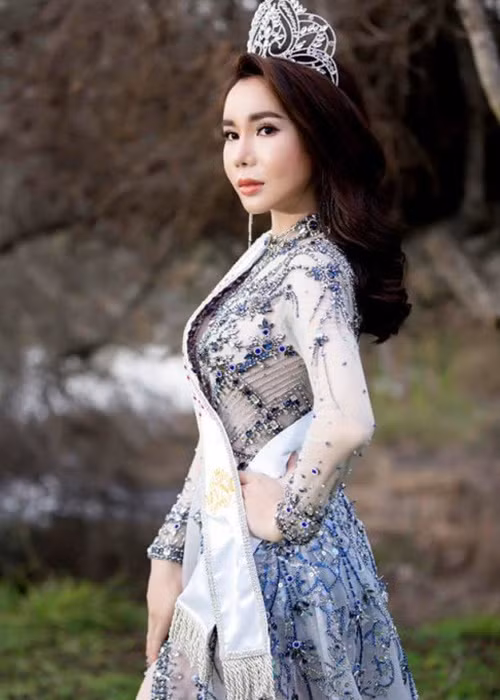 Chân dài sinh năm 1990 sở hữu vóc dáng thon gọn, gợi cảm. Ảnh: Sức khỏe đời sống