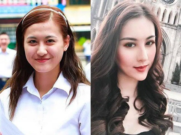 Hà Lade thời gian gần đây gây chú ý khi công khai hình ảnh phẫu thuật thẩm mỹ khuôn mặt. Được biết hot girl Hà thành gần như đụng chạm gần hết trên mặt như mở góc mắt, nâng mũi, thu gọn hàm,...