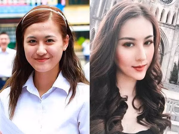 Hà Lade thời gian gần đây gây chú ý khi công khai hình ảnh phẫu thuật thẩm mỹ khuôn mặt. Được biết hot girl Hà thành gần như đụng chạm gần hết trên mặt như mở góc mắt, nâng mũi, thu gọn hàm,...