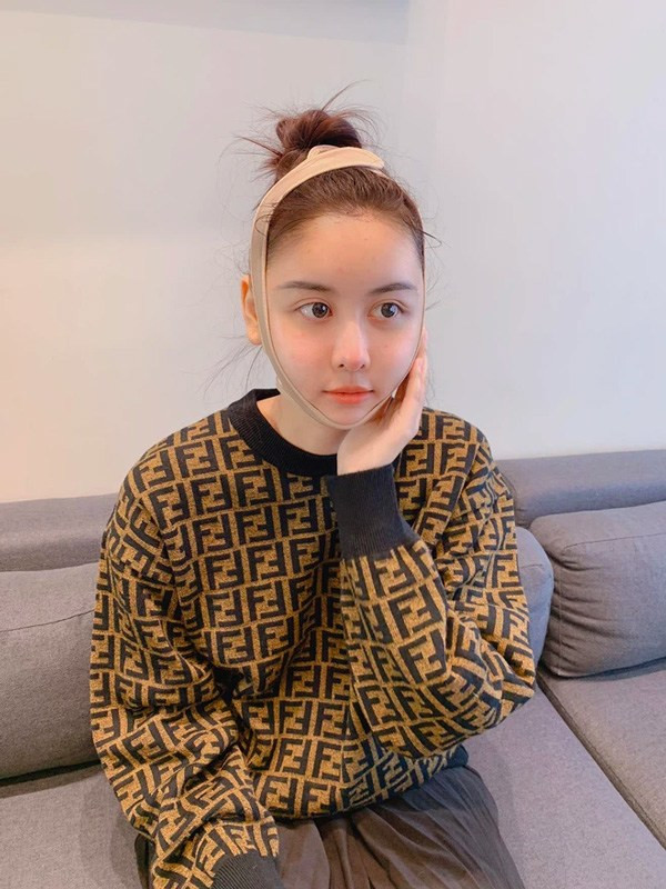 Việc thẩm mỹ đã biến Hà Lade trở thành một cô gái xinh đẹp, sắc sảo hơn.