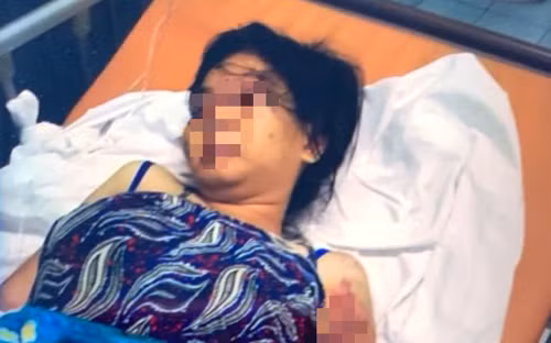 2 ke chu muu tra tan thai phu sa luoi, lo nhieu tinh tiet moi-Hinh-2