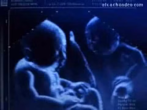 Những bé con sinh đôi nằm trong bụng mẹ với rất nhiều tư thế... buồn cười.