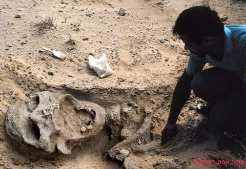 Bi an xuyen the ky ve ngon tay cua nguoi khong lo-Hinh-2