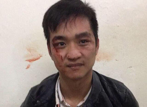 Cuop tiem vang nhan nhan: Thu doan tinh vi, ra tay cang tao ton