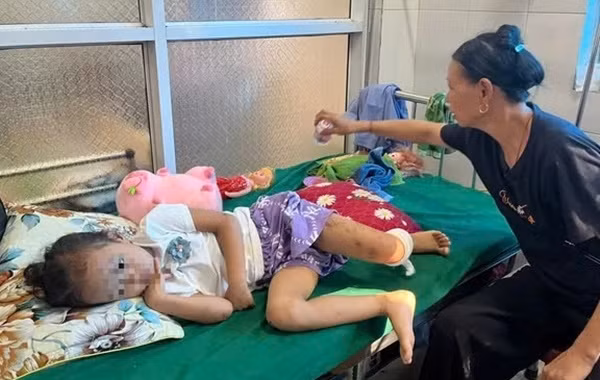 Tinh canh dang thuong cua be gai mo coi o Lang Nu