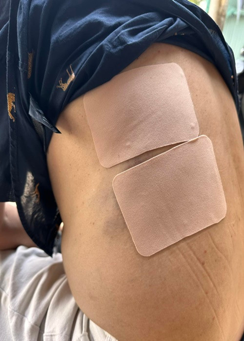 Tấn Lộc - con trai Tấn Beo sơ cứu cho bố sau cú ngã. Dù đau nhiều, Tấn Beo không muốn vào bệnh viện. Theo Vietnamnet, Tấn Beo ở nhà nghỉ ngơi, nhờ vợ con mua thuốc giảm đau. Ảnh: FB Tấn Beo.