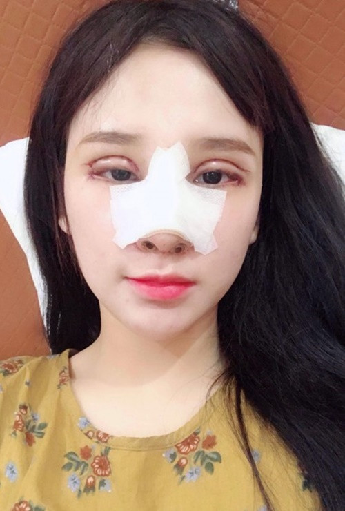 Yến Tatoo tự ti với đôi mắt nhỏ và nếp mí hơi sụp. Ngoài sửa mí mắt, cô sửa dáng mũi để có gương mặt Tây hơn. Ảnh: Vietnammoi.