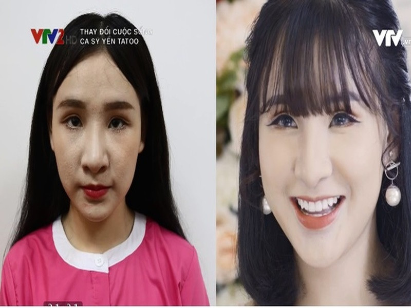 Năm 2018, Yến Tatoo công khai phẫu thuật thẩm mỹ. Ảnh: VTV.