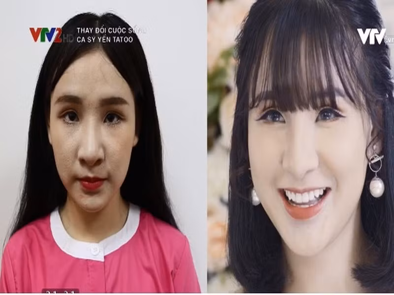 Năm 2018, Yến Tatoo công khai phẫu thuật thẩm mỹ. Ảnh: VTV.