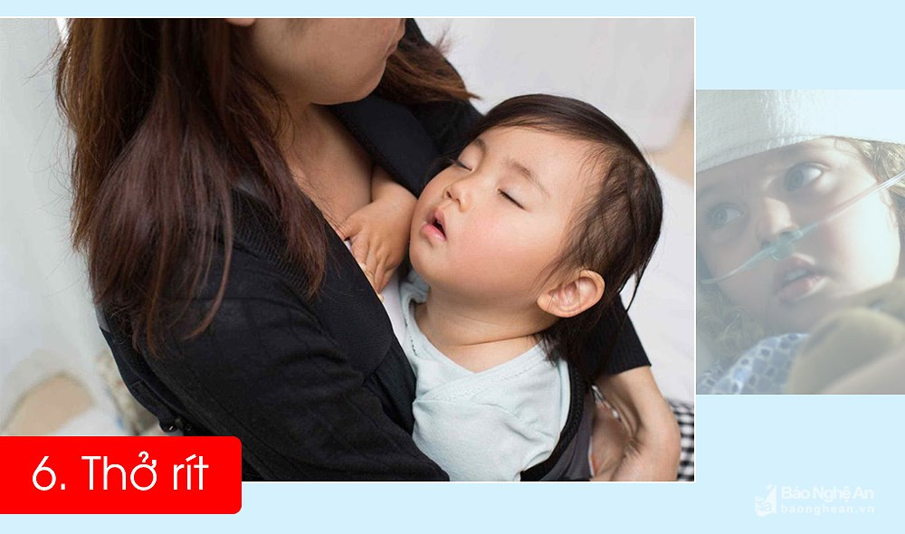 6 dau hieu ro ret nhat de phat hien tre bi viem phoi-Hinh-6
