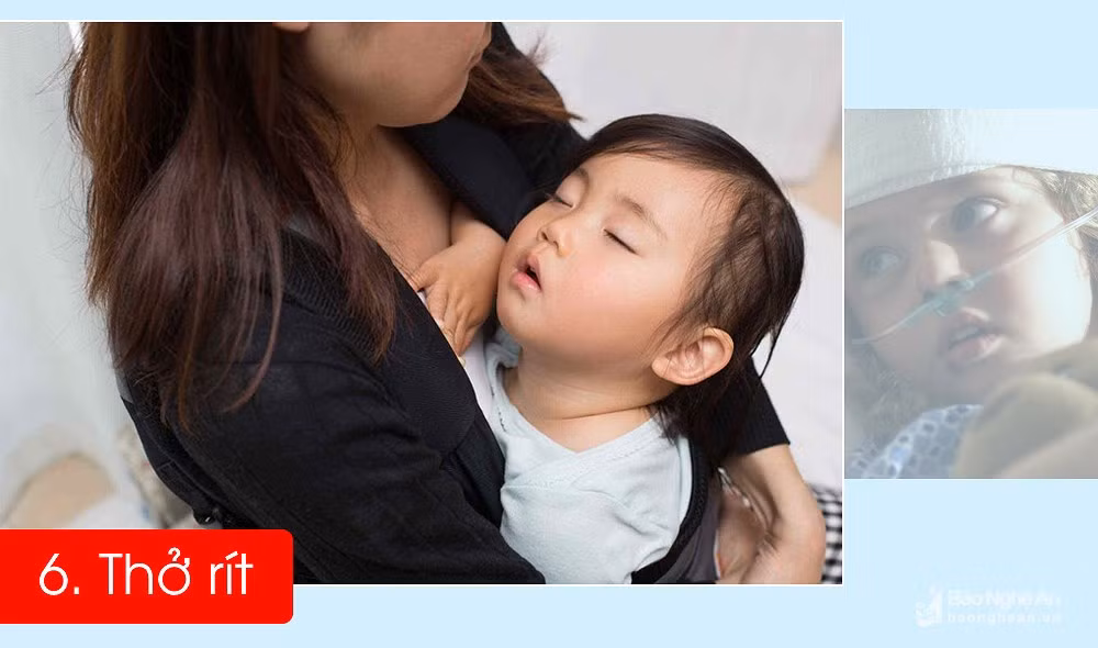 6 dau hieu ro ret nhat de phat hien tre bi viem phoi-Hinh-6