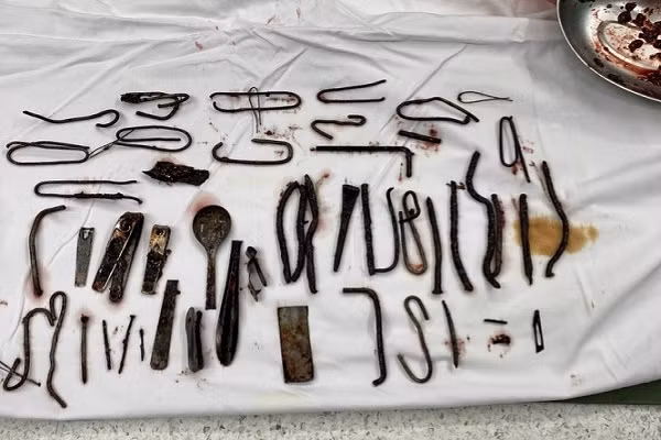 Tại sao nhiều trẻ em mắc chứng ăn thứ không để ăn ? Tai sao nhieu tre em mac chung an thu khong de an ?