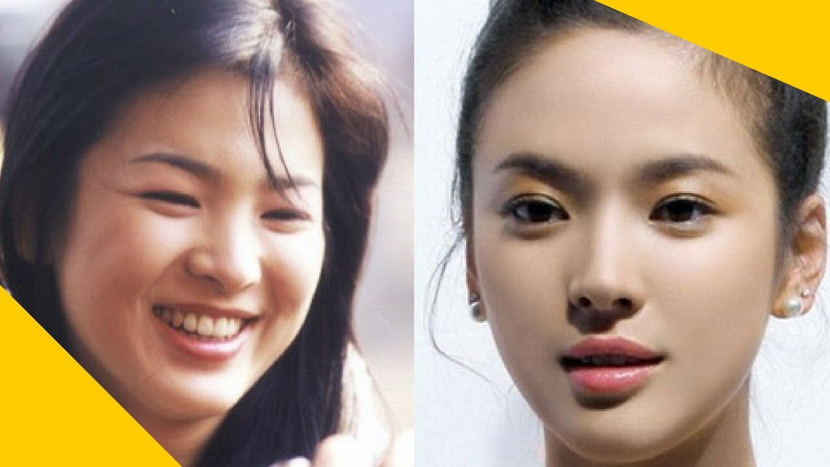 4 cach giam beo mat giup phu nu luon xinh tuoi, rang ro