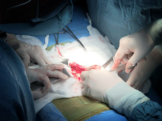 Viet Nam lan dau tien ghep than thanh cong cho tre em tu nguoi chet nao