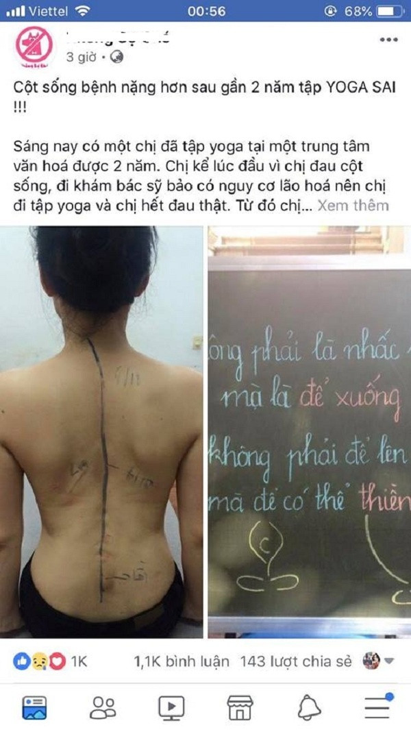 Tap yoga sai cach, co gai dau don vi benh cot song ngay cang nang