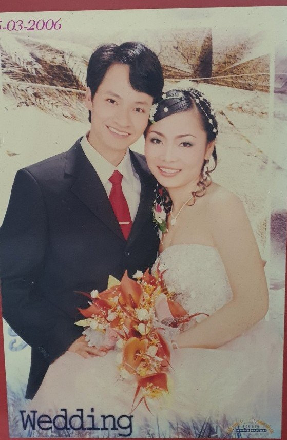 Nghi luc cua doi vo chong “vang” khuyet tat-Hinh-2