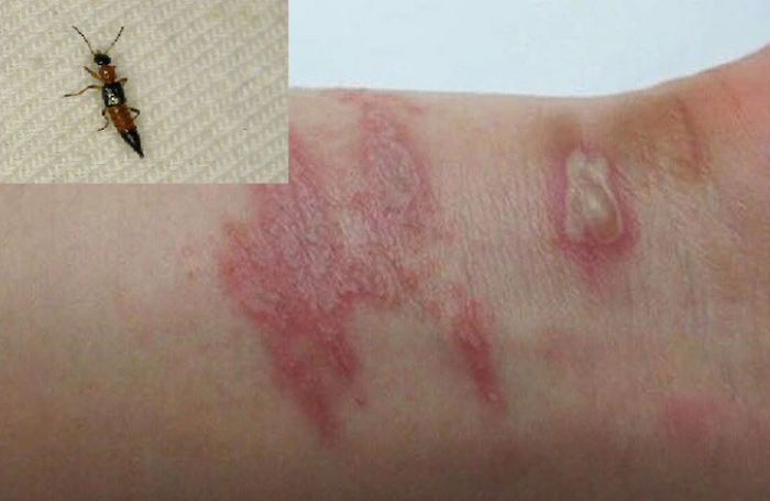 Cach duoi kien ba khoang khoi nha hieu qua, khong doc hai