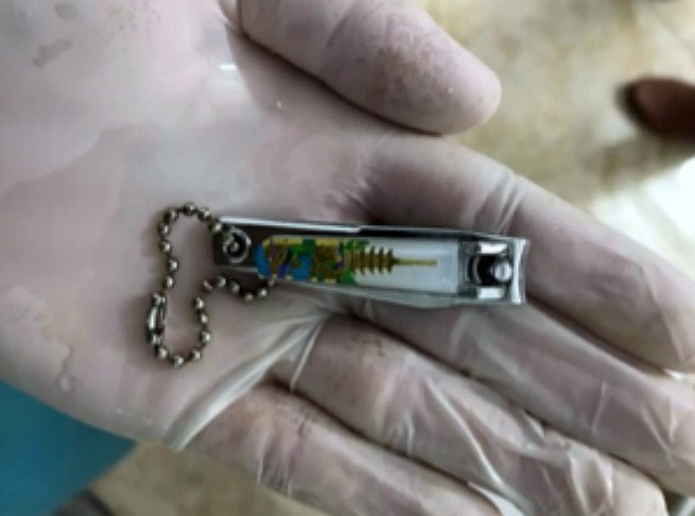 Các cơ sở y tế cho biết gần đây đã tiếp nhận nhiều ca bệnh hóc các dị vật ở trẻ nhỏ rất nguy hiểm. Việc xuất hiện tràn lan những video có nội dung xấu khiến trẻ em có nhận thực sai lệch về cuộc sống.