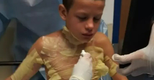 Năm 2019, cậu bé Jason (12 tuổi) ở tiểu bang Michigan (Mỹ) được đưa đến bệnh viện cấp cứu trong tình trạng bỏng nặng toàn thân. Nguyên nhân là vì cậu nhóc này đã bắt chước một trào lưu có tên "Fire Challenge" trên Youtube.