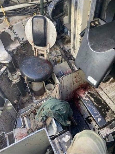 Hậu quả của vụ việc là chiếc xe tăng đồng đội bị hư hỏng nặng nề và pháo thủ của xe bị thương nghiêm trọng, chưa rõ mức độ tổn hại của các binh sĩ khác trong kíp lái và độ thiệt hại của xe. Ảnh: Bên trong khoang lái nơi pháo thủ ngồi của xe tăng M1 Abrams dính đạn.