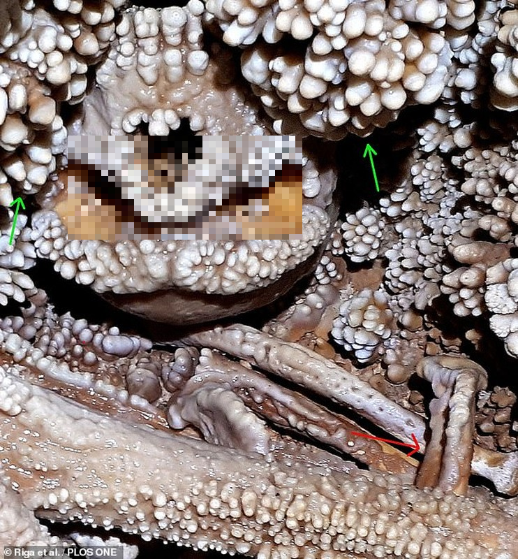 Hàm của người Neanderthal rộng hơn, cằm không nhô ra như thường thấy ở con người ngày nay. Phân tích vết mòn và cao răng trên các răng khác cung cấp cho các nhà khoa học thêm thông tin về chế độ ăn của người Neanderthal và cách họ sử dụng răng cho những hoạt động khác ngoài ăn.