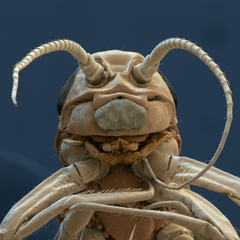 7. Chấy xứng đáng là sinh vật cứng đầu nhất quả đất khi hút máu. Chúng bám chặt vào da đầu nhờ những “cánh tay mạnh mẽ” đầy gai móc dính nhớp nháp.