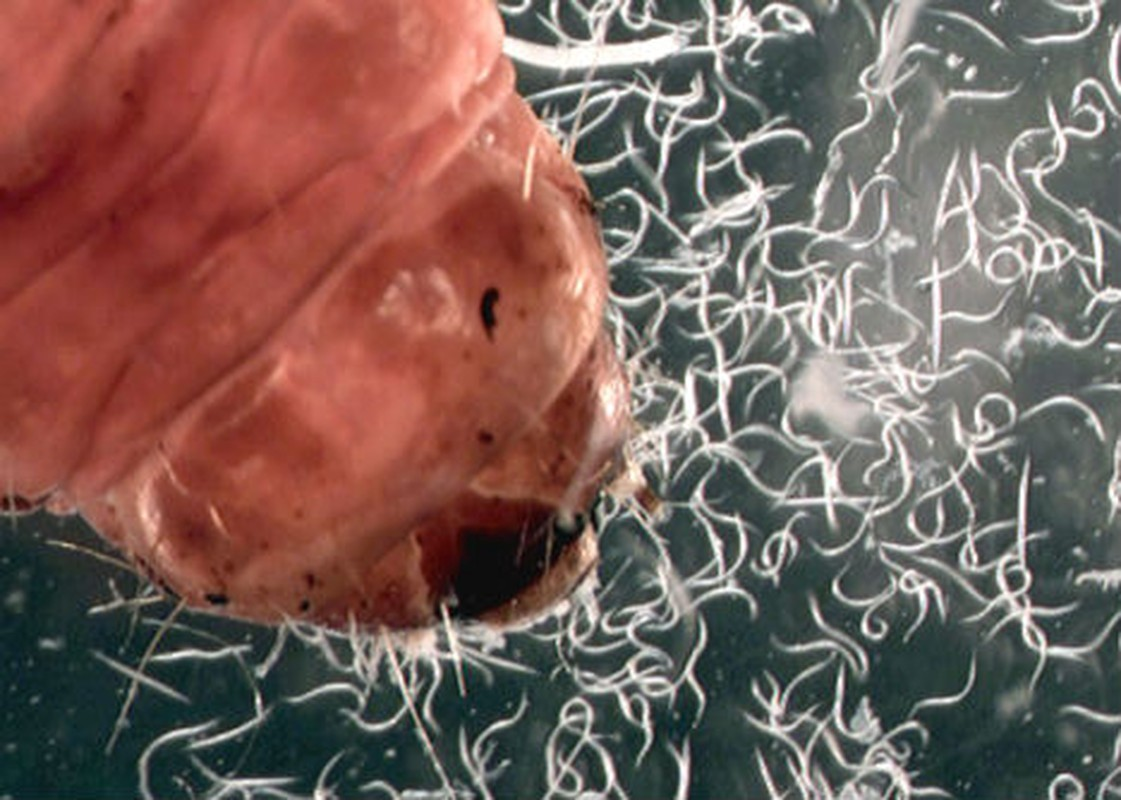 4. Giun tròn dưới ống kính hiển vi. Giun tròn là nhóm các động vật thuộc ngành Nematoda. Chúng gồm những động vật sinh sống ở một phạm vi môi trường rộng lớn. Giun tròn có hệ thống tiêu hóa hở hai đầu.