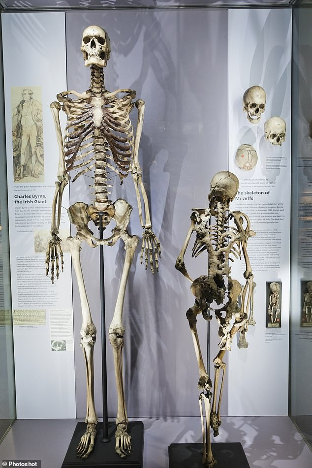 Bằng cách này, bộ xương của Byrne đã tiếp tục đứng đó trong suốt 200 năm - thách thức những nguyên tắc đạo đức, khoa học và cả pháp lý.