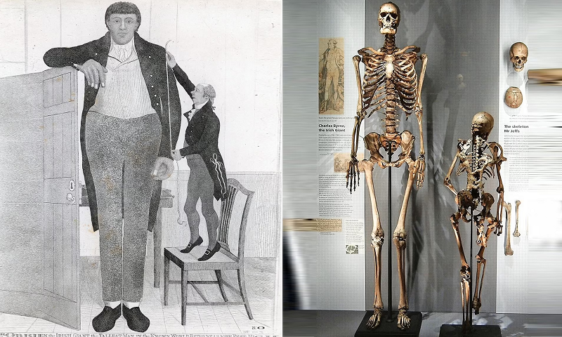 Chỉ vì thân hình quá khổ của mình mà Charles Byrne đã phải gặp nhiều rắc rối trong cuộc sống. Thậm chí đến khi ông chết mọi người vẫn luôn bàn tàn về ông.