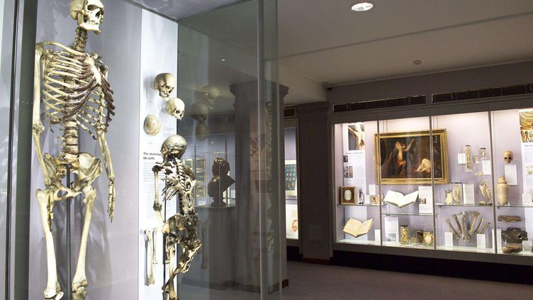 Không ai biết họ nên làm gì với hài cốt của Byrne. Bảo tàng nói bộ xương đã là tài sản của họ, trong khi các luật sư nói tất cả mọi người phải tôn trọng ý nguyện được chôn cất dưới biển của Byrne khi còn sống.