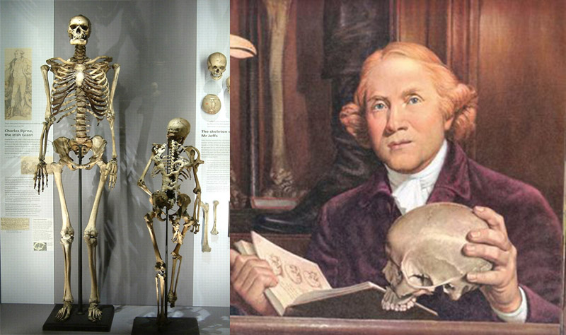 Nhưng những nhà đạo đức nói rằng bởi các nhà khoa học đã trích xuất được DNA của anh ấy, người khổng lồ Ireland nên được yên nghỉ.