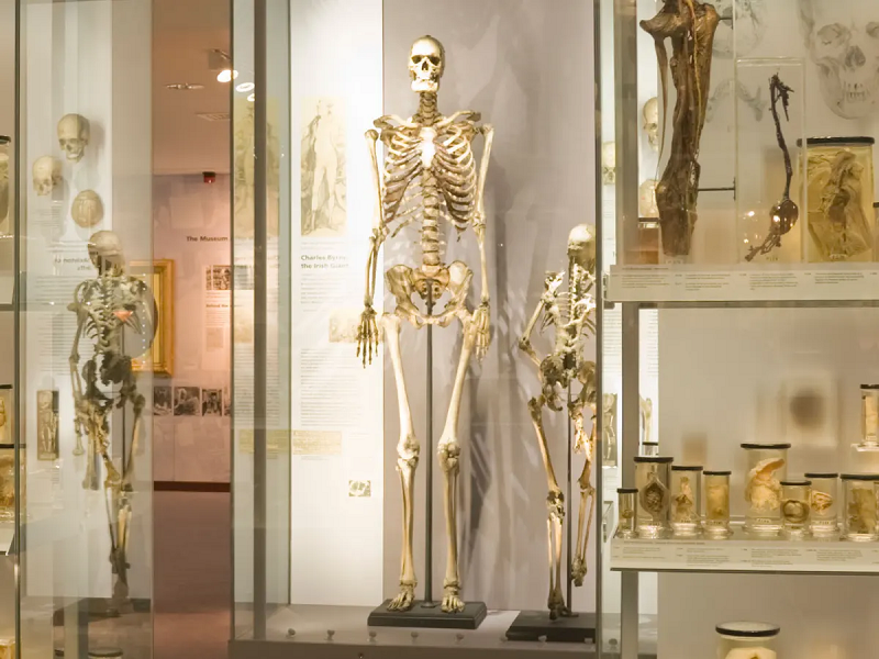 Mặc dù vậy, Byrne nên được yên nghỉ như thế nào thì lại là một câu hỏi bỏ ngỏ. Vụ việc này trở thành một trong những cuộc tranh cãi lớn nhất trong lịch sử y học nước Anh.