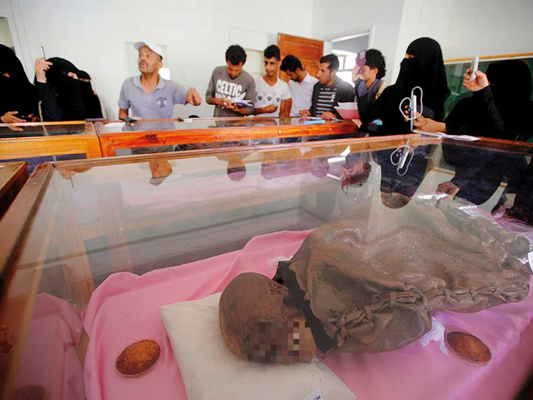 Việc bảo quản khá cầu kỳ, yêu cầu một môi trường kiểm soát nhiệt độ, vệ sinh sáu tháng một lần và bổ sung các hóa chất bảo quản. Tuy nhiên, trong hoàn cảnh chiến sự liên miên, điều kiện bảo quản, vệ sinh và chăm sóc các xác ướp này đều không đạt tiêu chuẩn.