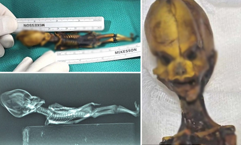 Cũng có hốc mắt, mũi và miệng nhưng phần hộp sọ lại rất lớn và kết cấu xương hàm cũng khác xa so với con người.