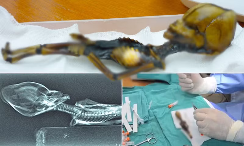  Bộ xương kỳ lạ này có cấu tạo như người nhưng kích thước chỉ dài bằng cặp kính mắt thông thường. Đặc biệt phần xương sọ có cấu tạo khác biệt hoàn toàn so với con người.