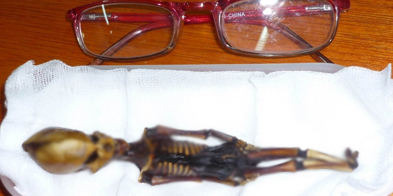 Sọ não được cấu tạo theo kiểu "xếp lớp" hoàn toàn không giống với con người.