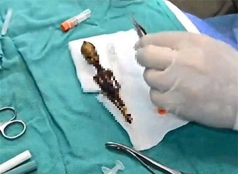 Hệ thống xương này cũng chứng tỏ rằng "người tí hon" này có khả năng di chuyển bằng hai chân thẳng đứng như con người, điều mà không mấy loài linh trưởng có thể làm được.