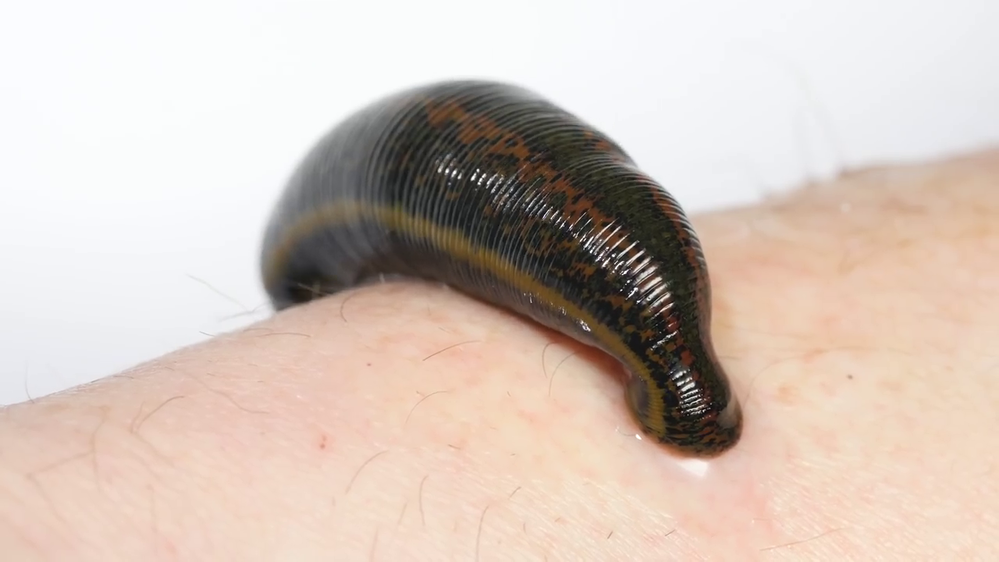 2. Đỉa có tới 32 bộ não: Loài động vật này có tới 5 đôi mắt, 300 chiếc răng và 32 bộ não. Thực tế loài này chỉ có một bộ não, nhưng bộ não của chúng được tạo thành từ 32 hạch. Và hạch là cụm các tế bào thần kinh có chức năng sắp xếp và xử lý các dấu hiệu của cơ thể, nhận tín hiệu từ cơ thể và chuyển những tín hiệu quan trọng đến não nên có thể coi như đỉa có đến 32 bộ não.