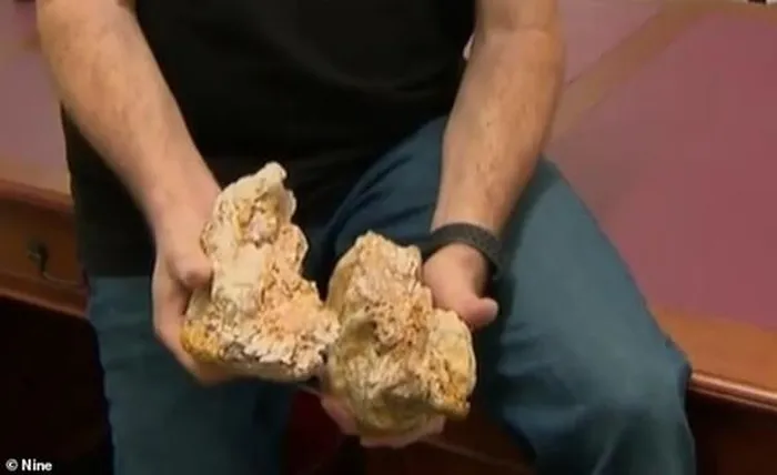 Nhưng người khai thác chỉ mang một nửa tảng đá, nửa còn lại để ở nhà. Sau đó họ đã ghép hai nửa lại với nhau và nhận thấy nó có tổng khoảng 82 ounce vàng trong đó.