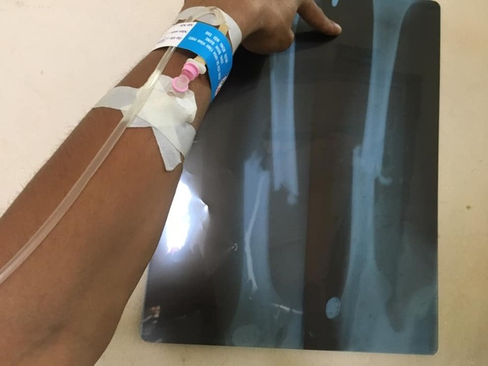 Cai ket cua nam thanh nien voi di gap nguoi yeu cu truoc ngay len xe hoa